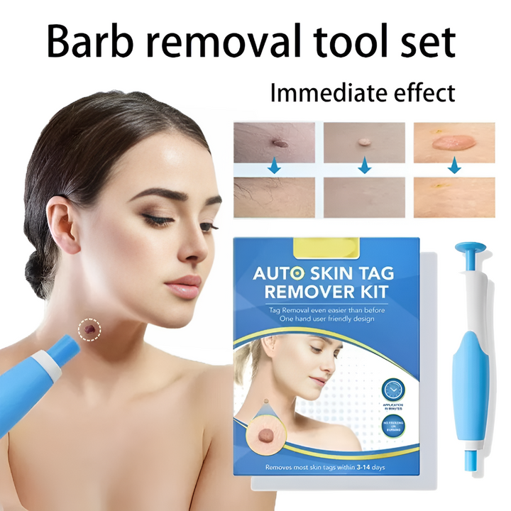 Skin Tag Removal Kit